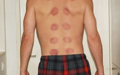 Culturally Sensitive Medicine