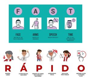 The English acronym FAST and the Spanish acronym RÁPIDO for stroke detection